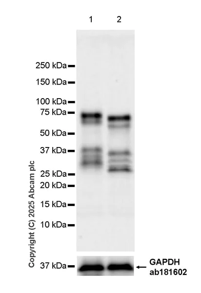 Western blot - Anti-FXI antibody [EPR29204-87] (AB323450)