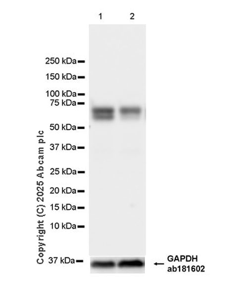 Western blot - Anti-FXI antibody [EPR29204-87] (AB323450), expandable thumbnail