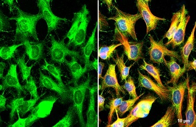 Immunocytochemistry/ Immunofluorescence - Anti-FXR1 antibody (AB155124)