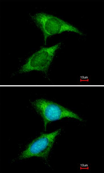 Immunocytochemistry/ Immunofluorescence - Anti-FXR1 antibody (AB155124), expandable thumbnail