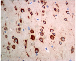 Immunohistochemistry (Formalin/PFA-fixed paraffin-embedded sections) - Anti-FXR1 antibody [EPR7932] (AB129089), expandable thumbnail
