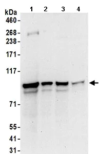 Western blot - Anti-FXR2 antibody (AB168852)