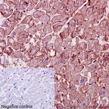 Immunohistochemistry (Formalin/PFA-fixed paraffin-embedded sections) - Anti-FXYD1/PLM antibody [EPR16081] (AB191397)