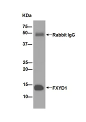 Immunoprecipitation - Anti-FXYD1/PLM antibody [EPR16081] - BSA and Azide free (AB251062)