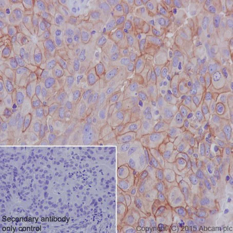Immunohistochemistry (Formalin/PFA-fixed paraffin-embedded sections) - Anti-FXYD3 antibody [EPR17160] (AB205534)
