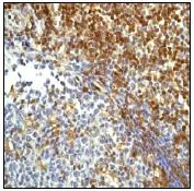 Immunohistochemistry (Formalin/PFA-fixed paraffin-embedded sections) - Anti-FYB antibody [EP2546Y] (AB76103)