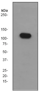 Western blot - Anti-FYB antibody [EP2546Y] (AB76103)