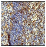 Immunohistochemistry (Formalin/PFA-fixed paraffin-embedded sections) - Anti-FYB antibody [EPR2547Y] - BSA and Azide free (AB247426)