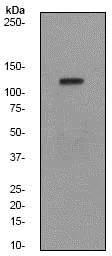 Western blot - Anti-FYB antibody [EPR2547Y] - BSA and Azide free (AB247426)