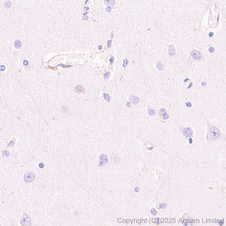 Immunohistochemistry (Formalin/PFA-fixed paraffin-embedded sections) - Anti-FYCO1 antibody [EPR28360-524] (AB324455)