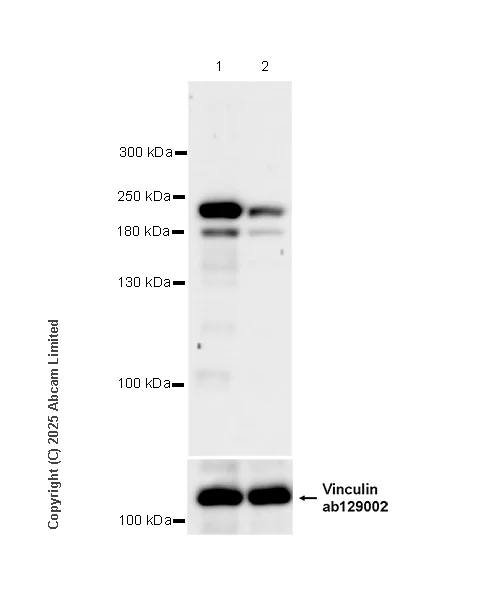 Western blot - Anti-FYCO1 antibody [EPR28360-524] (AB324455)