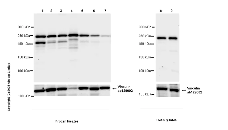 Western blot - Anti-FYCO1 antibody [EPR28360-524] (AB324455)