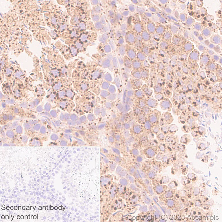 Immunohistochemistry (Formalin/PFA-fixed paraffin-embedded sections) - Anti-FYCO1 antibody [EPR28361-79] (AB316012)