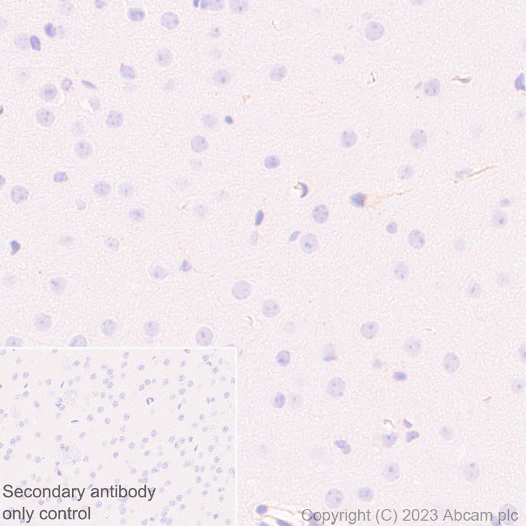 Immunohistochemistry (Formalin/PFA-fixed paraffin-embedded sections) - Anti-FYCO1 antibody [EPR28361-79] (AB316012)