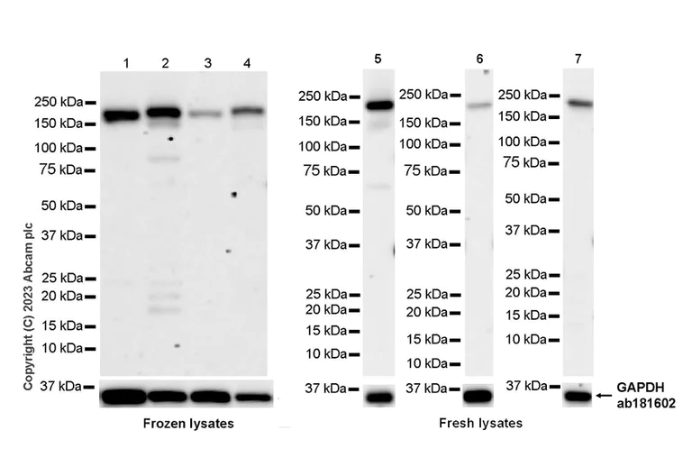 Western blot - Anti-FYCO1 antibody [EPR28361-79] (AB316012)
