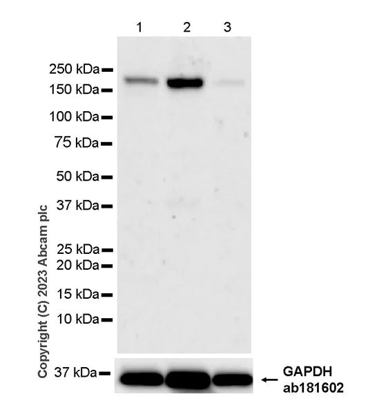 Western blot - Anti-FYCO1 antibody [EPR28361-79] - BSA and Azide free (AB316013)