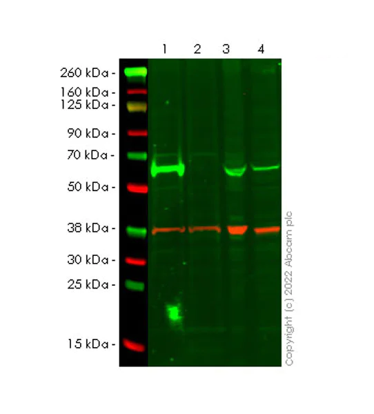 Western blot - Anti-Fyn antibody [25/FYN] - BSA and Azide Free (AB300728)