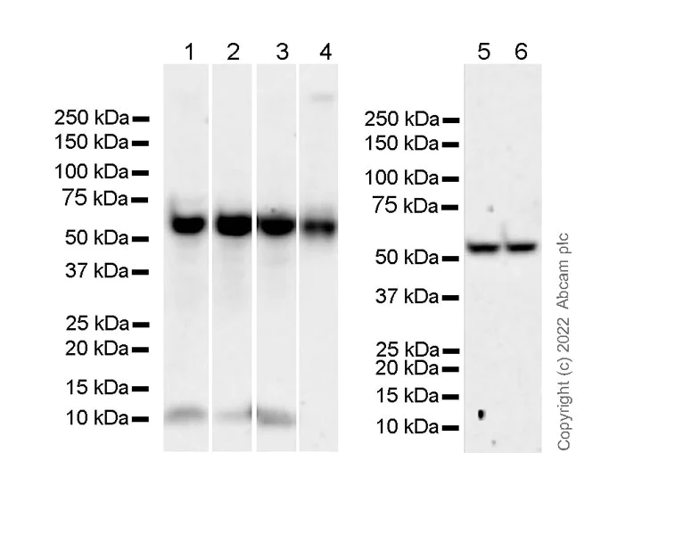 Western blot - Anti-Fyn antibody [25/FYN] - BSA and Azide Free (AB300728)