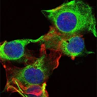 Immunocytochemistry/ Immunofluorescence - Anti-Fyn antibody [2A10] (AB119855)