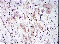 Immunohistochemistry (Formalin/PFA-fixed paraffin-embedded sections) - Anti-Fyn antibody [2A10] (AB119855)