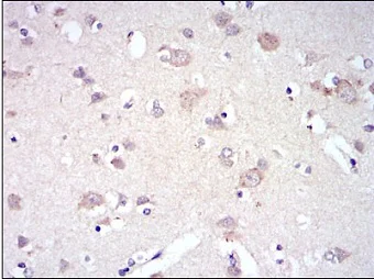 Immunohistochemistry (Formalin/PFA-fixed paraffin-embedded sections) - Anti-Fyn antibody [2A10] (AB119855)