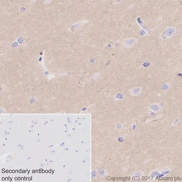 Immunohistochemistry (Formalin/PFA-fixed paraffin-embedded sections) - Anti-Fyn antibody [EPR19636] (AB184276)