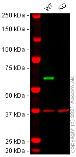 Western blot - Anti-Fyn antibody [EPR19636] (AB184276)