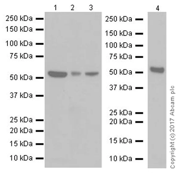 Western blot - Anti-Fyn antibody [EPR19636] (AB184276)