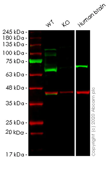 Western blot - Anti-Fyn antibody [EPR19636] (AB184276)