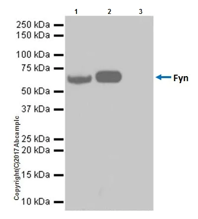 Immunoprecipitation - Anti-Fyn antibody [EPR19636] - BSA and Azide free (AB246333)