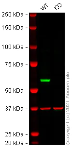 Western blot - Anti-Fyn antibody [EPR5500] (AB125016)