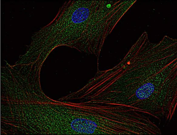 Immunocytochemistry - Anti-Fyn antibody [FYN-01] (AB1881)