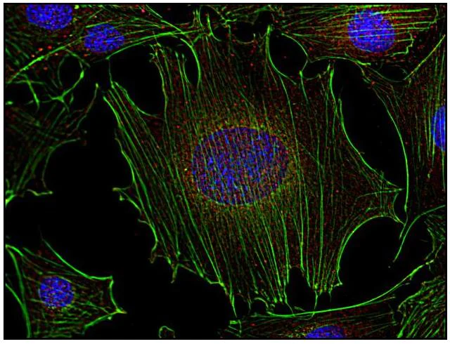 Immunocytochemistry - Anti-Fyn antibody [FYN-01] (AB1881)