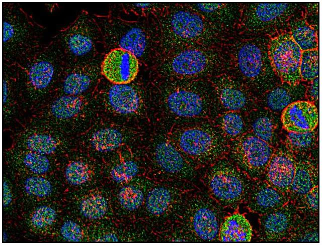 Immunocytochemistry - Anti-Fyn antibody [FYN-01] (AB1881)