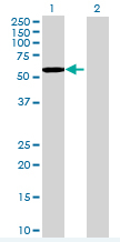 Western blot - Fyn overexpression 293T lysate (whole cell) (AB94223), expandable thumbnail