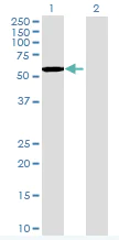 Western blot - Fyn overexpression 293T lysate (whole cell) (AB94223)