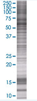 Western blot - Fyn overexpression 293T lysate (whole cell) (AB94223), expandable thumbnail