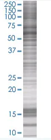 Western blot - Fyn overexpression 293T lysate (whole cell) (AB94223)