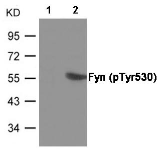 Western blot - Anti-Fyn (phospho Y530) antibody (AB182661), expandable thumbnail
