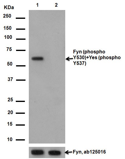 Western blot - Anti-Fyn (phospho Y530) + Yes1 (phospho Y537) antibody [EPR13512] - BSA and Azide free (AB238975), expandable thumbnail