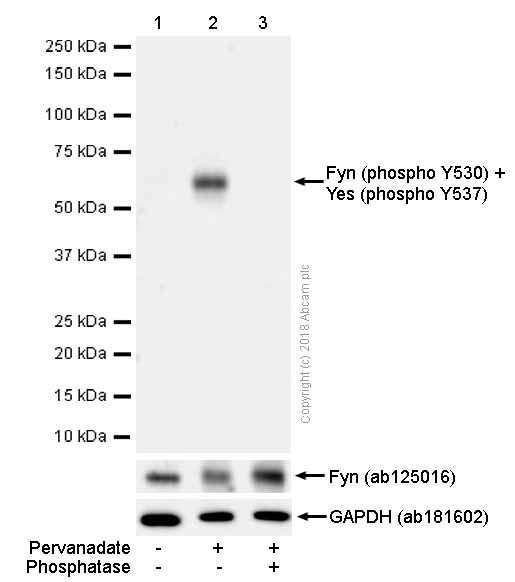 Western blot - Anti-Fyn (phospho Y530) + Yes1 (phospho Y537) antibody [EPR13512] - BSA and Azide free (AB238975), expandable thumbnail