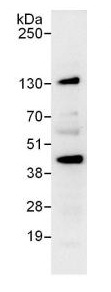 Immunoprecipitation - Anti-FYTTD1 antibody (AB125082)