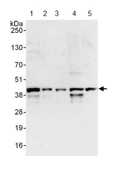 Western blot - Anti-FYTTD1 antibody (AB125082)