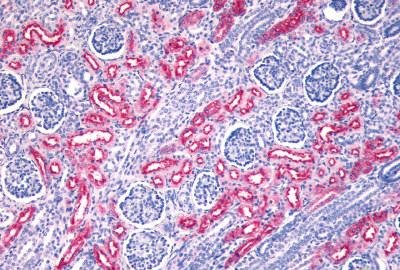 Immunohistochemistry (Formalin/PFA-fixed paraffin-embedded sections) - Anti-FZD10 antibody (AB150564)