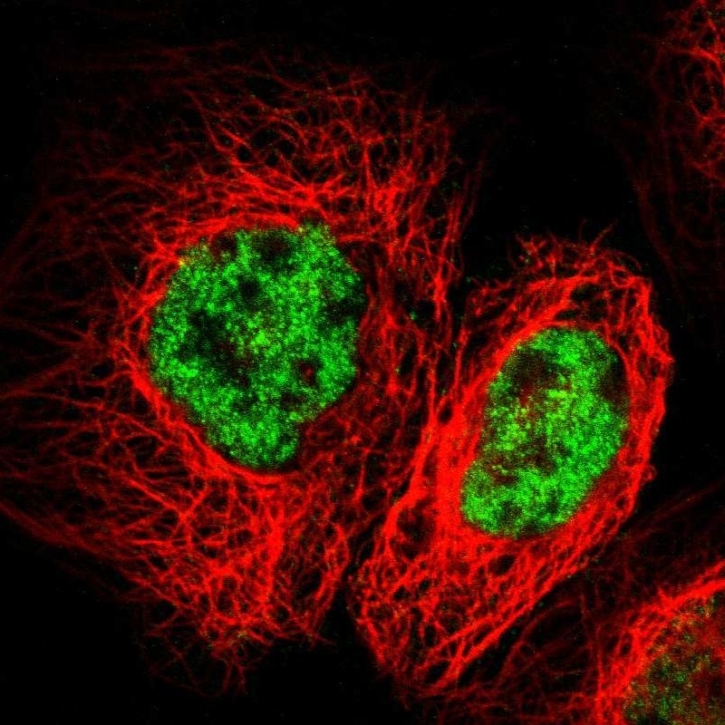 Immunocytochemistry/ Immunofluorescence - Anti-FZD10 antibody (AB254588)