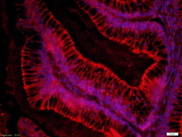 Immunocytochemistry/ Immunofluorescence - Anti-FZD3 antibody (AB217032), expandable thumbnail