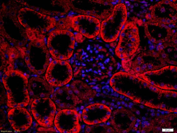 Immunocytochemistry/ Immunofluorescence - Anti-FZD3 antibody (AB217032), expandable thumbnail