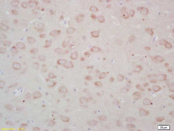 Immunohistochemistry (Formalin/PFA-fixed paraffin-embedded sections) - Anti-FZD3 antibody (AB217032), expandable thumbnail