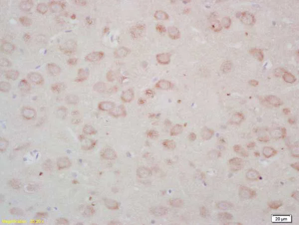 Immunohistochemistry (Formalin/PFA-fixed paraffin-embedded sections) - Anti-FZD3 antibody (AB217032)