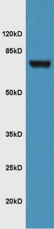 Western blot - Anti-FZD3 antibody (AB217032), expandable thumbnail